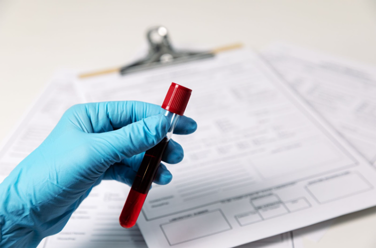 10 Most Common Blood Tests